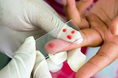 Diagnosis of pain in the fingertips