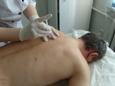 Intra-articular injections of chondroprotectors for thoracic osteochondrosis.