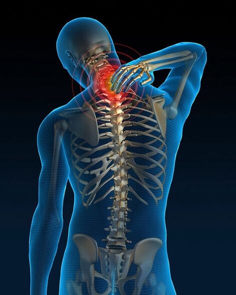 At the initial stage of treatment of cervical osteochondrosis, pain in the neck increases. 